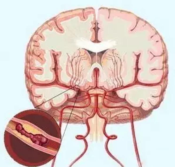 缺氧引起神经细胞兴奋性降低的原因探究_最佳精选解释落实