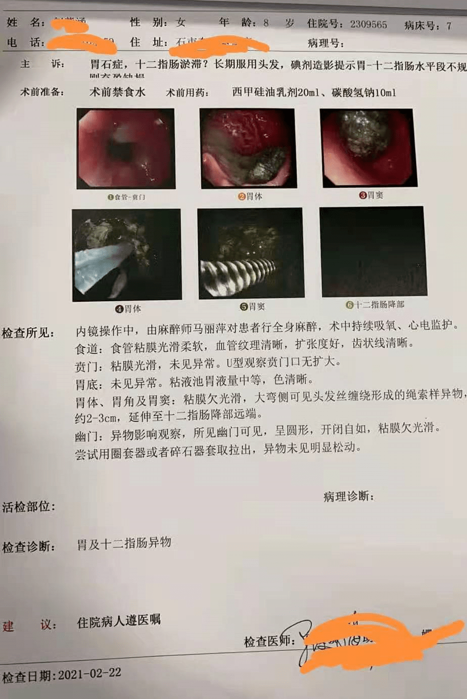 吃糖葫芦长出胃结石正常吗？揭秘背后的真相