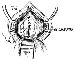 つ低调°╭为你狂乱⌒ 第11页