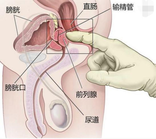 前列腺切除最新技术，探索未来的医疗革新之旅