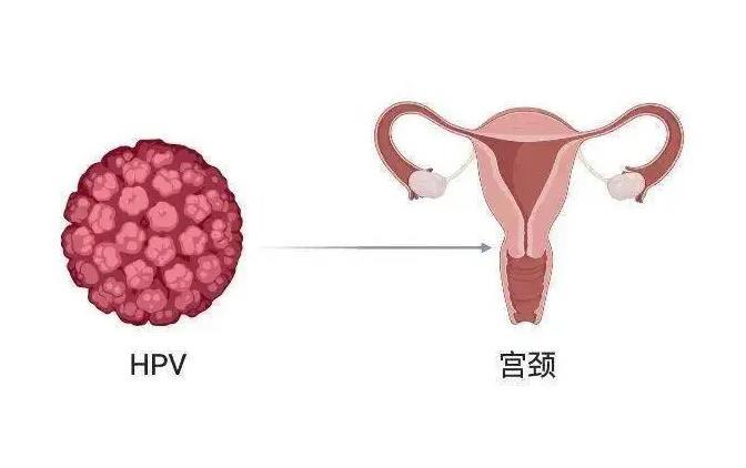 室友感染HPV要换宿舍吗？——一场宿舍生活的轻松讨论