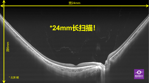 狱中苦读24年成博士