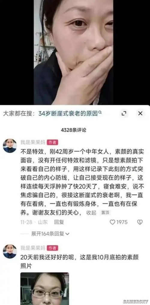 患渐冻症容貌巨变女生已无法说话，坚强与勇气的故事