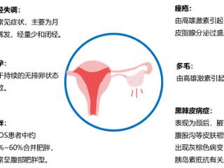 多囊不仅仅是妇科病，你可能忽视的真相