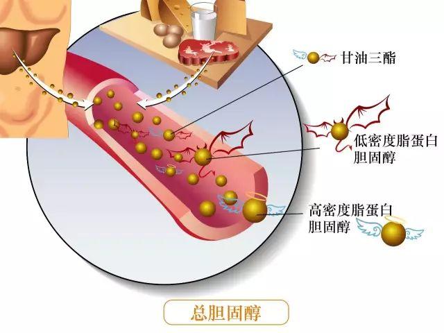 刚满6周的婴儿确诊高血脂