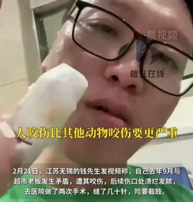 他竟被老板咬伤，险些截肢！背后的真相让人心惊